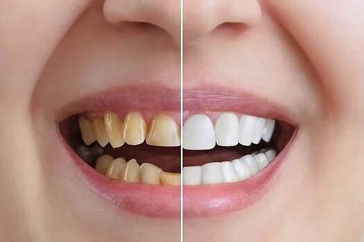 Cosmetic Dentistry: Innovations and Options for 2026 at Rovi Smile Center in Coral Springs, Florida